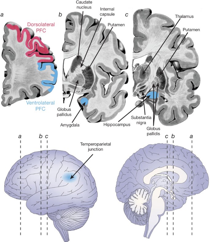 Hugo Chrost (@chrost_hugo) on Twitter photo Brain regions functionally and/or structurally affected in schizophrenia.
Source: <a href="/NatureNeuro/">Nature Neuroscience</a>
#neuroscience #MedTwitter Brain regions functionally and/or structurally affected in schizophrenia.
Source: <a href="/NatureNeuro/">Nature Neuroscience</a>
#neuroscience #MedTwitter