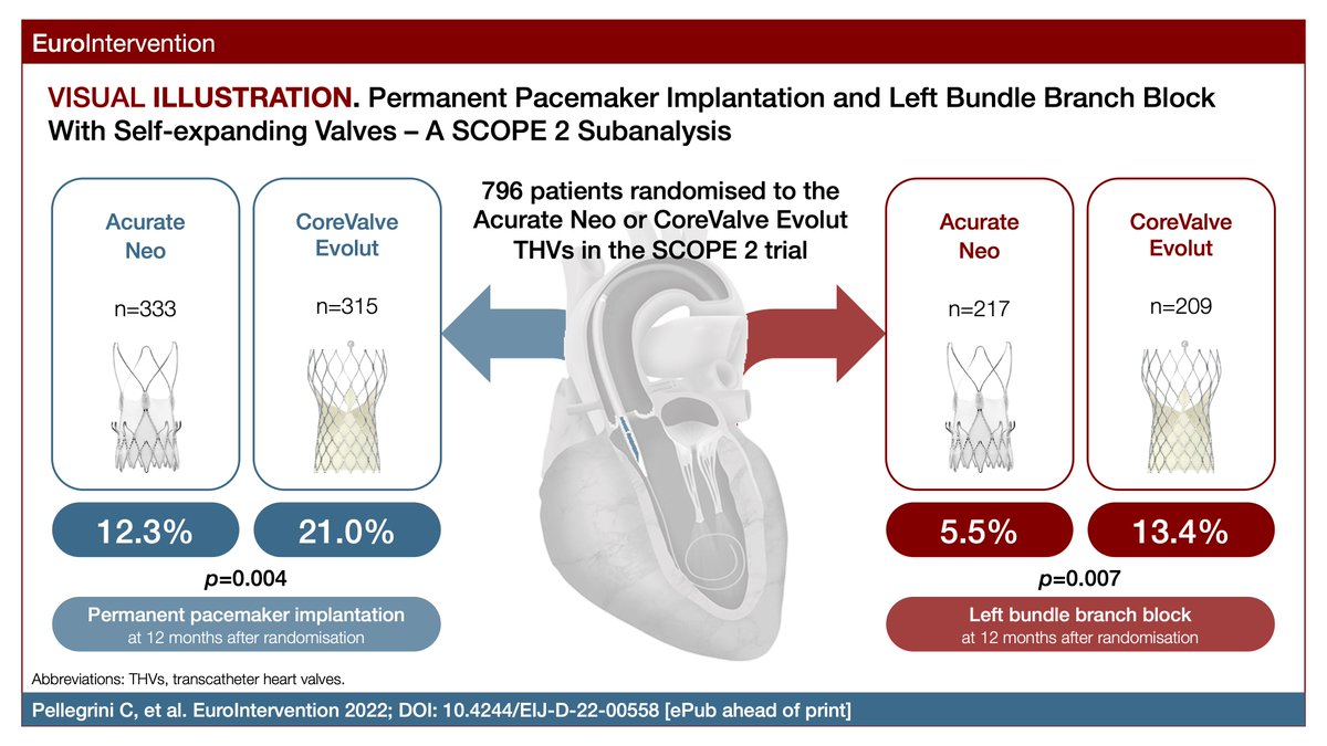 In this analysis of the SCOPE-2 randomised trial, the authors found that new conduction abnormalities and new permanent pacemaker implantation were significantly lower after TAVI when using the ACURATE neo valve compared to the CoreValve Evolut valve. ow.ly/R34g50MPLL0