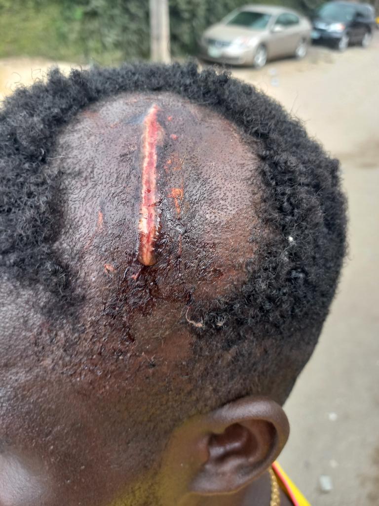 lacisca's tweet photo. @followlastma
This is what one of you did to my dispatch rider yesterday 10/02/2023.This is ruthless.He was tryin to use the roundabout at iyanaipaja and a Latsma Officer did this to him and fled when he noticed he was bleeding profusely.
@jidesanwoolu @lagosstategov @cmcikeja https://t.co/grKls1Mxe7