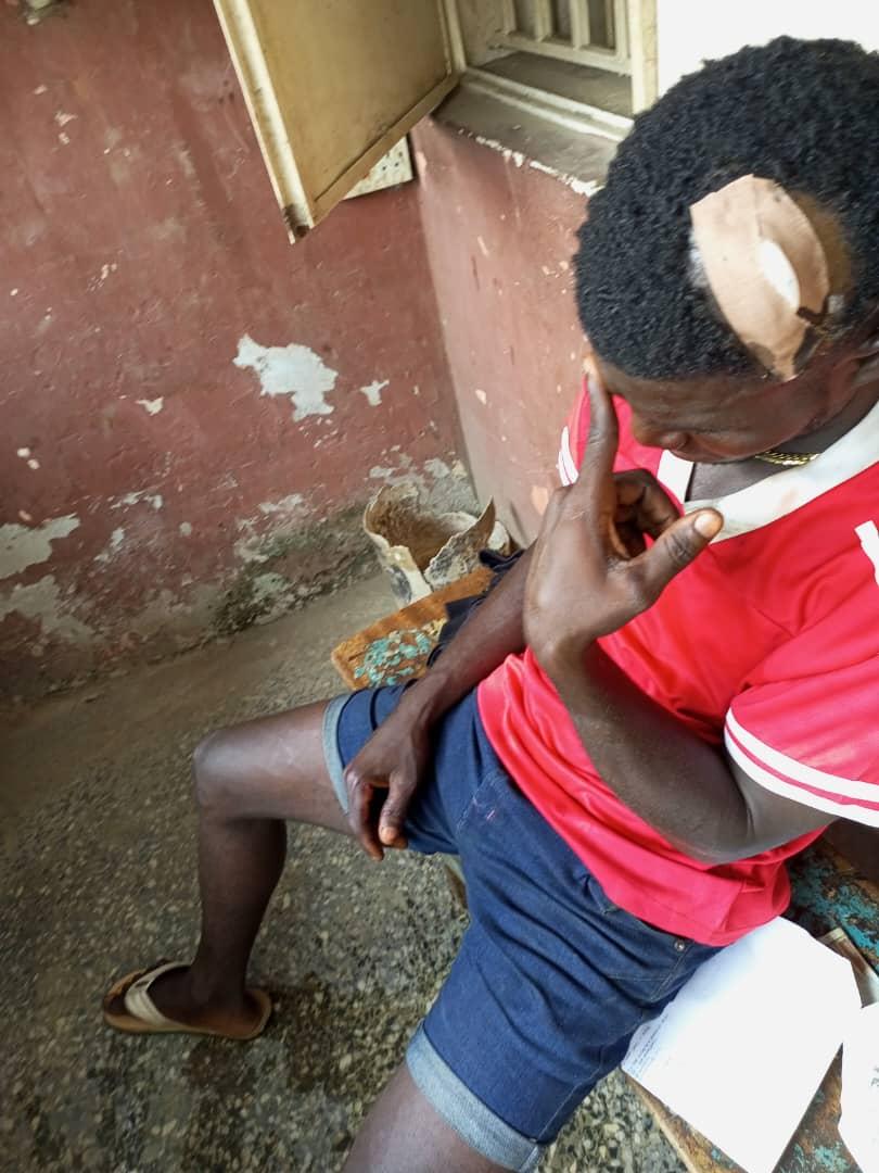 lacisca's tweet photo. @followlastma
This is what one of you did to my dispatch rider yesterday 10/02/2023.This is ruthless.He was tryin to use the roundabout at iyanaipaja and a Latsma Officer did this to him and fled when he noticed he was bleeding profusely.
@jidesanwoolu @lagosstategov @cmcikeja https://t.co/grKls1Mxe7