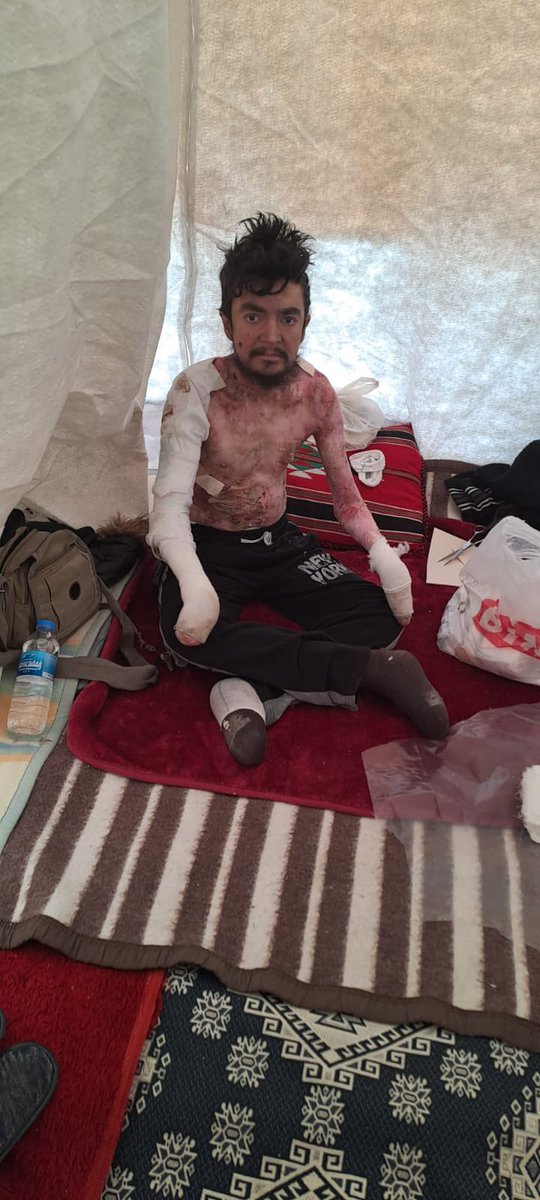 şanlıurfadayım.. depremden dolayı ailemin yanına geldim pansuman olmak için.. pansuman bitince bakım evine geri döneceğim.. bana taşınabilir, 2 göz soba yakacak güçte bir jeneratör lazım.. adım Yusuf Kemal Demir..telefonum 0552 947 4852