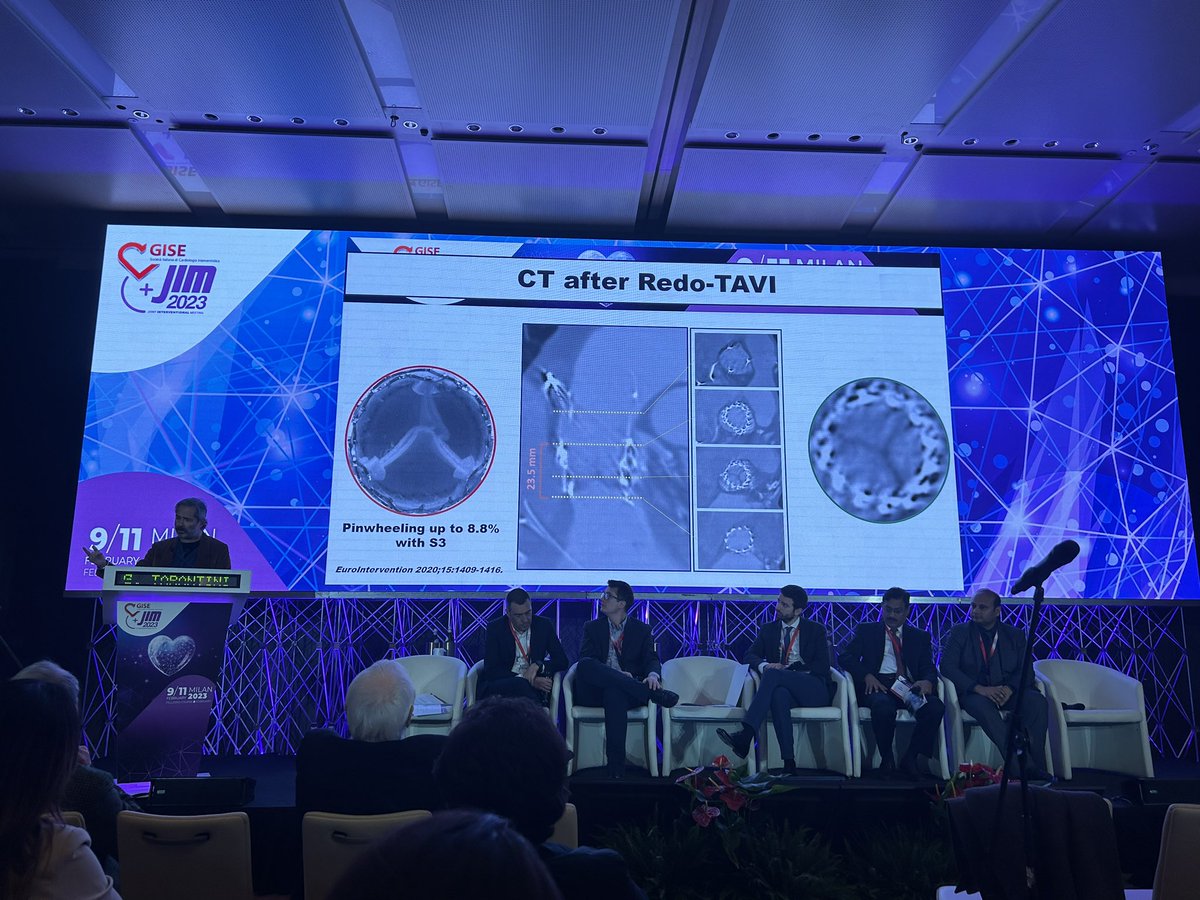 Take Home Messages from the last (but not least) Live in the Box from Padua @ #JIMGISE2023 <a href="/sicigise/">Sici GISE</a> 
<a href="/G_Tarantini01/">Giuseppe_Tarantini</a> introduced us a dedicated stepwise approach for THV in THV
👉Several aspects to be taken into account when planning ViV.
👉Post-procedural CT scan to be considered