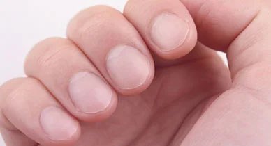 uncoverthefact's tweet image. Did you know that nails grow from the base of the nail bed, not the tips? On average, fingernails grow about 3.5 mm per month, but this can vary based on age, health, and other factors. Keep those nails healthy with a balanced diet and proper nail care! #NailFacts #HealthyHabits