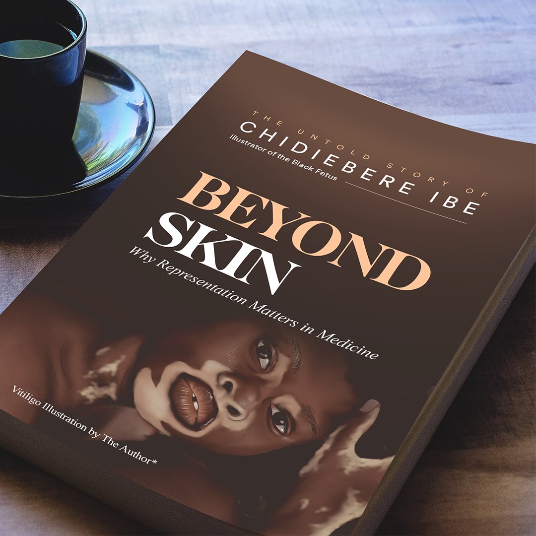 ebereillustrate's tweet photo. BEYOND SKIN!

I conceived this deep title two(2) years ago and to buttress the title, I decide to imprint “My Untold Success Story” in this book. 

 This book will blow your mind!
•Representation Matters in Medicine and we have to overemphasize this!

ANTICIPATE THE RELEASE! https://t.co/0GqJNBjwM0
