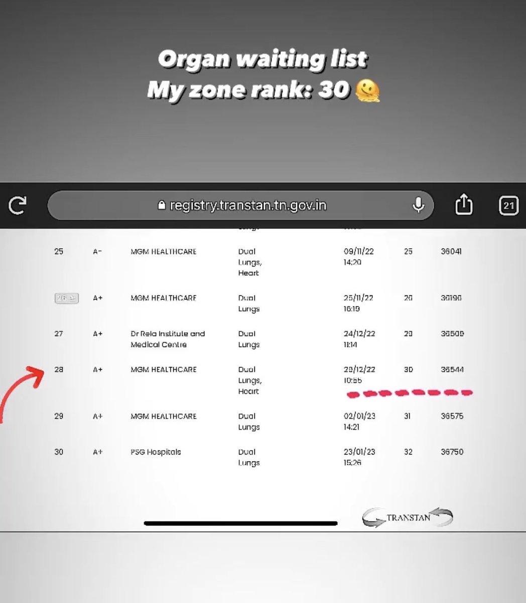 From 35 to 30 in 1.5 months

Ummmm…..

Feels like infinite waiting… 😶

.
.

#heartlungtransplant #doublelungtransplant