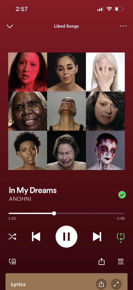 Amakinox's tweet photo. Anhoni - In my dreams. https://t.co/EXeVVJ0sso