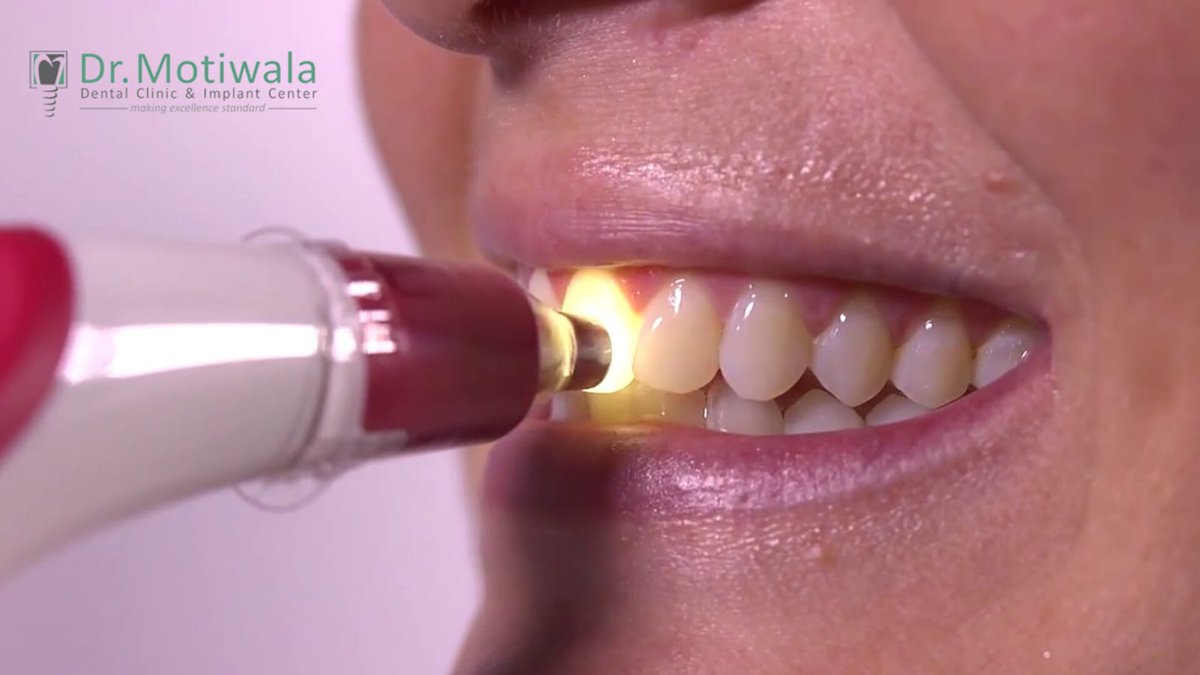 drmotiwaladcic's tweet photo. The VITA Easy shade digital spectrophotometer was developed for precise, fast and reliable shade determination of natural teeth and #ceramic restorations. #Toothcolor is a very personal choice, by following a Shade Guide of #Teeth, you can create a look that is perfect for you. https://t.co/vbWq0L92yg