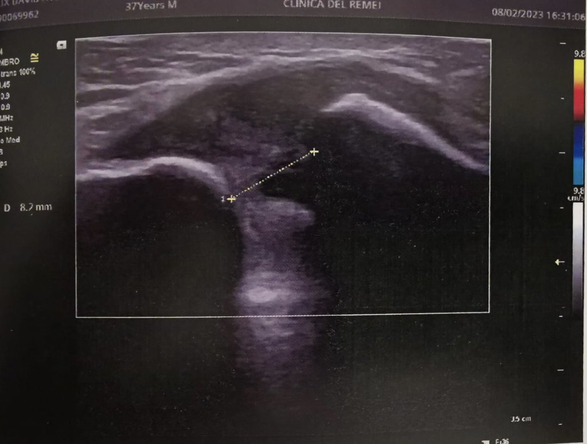 Alien World Project 👽 tweet media