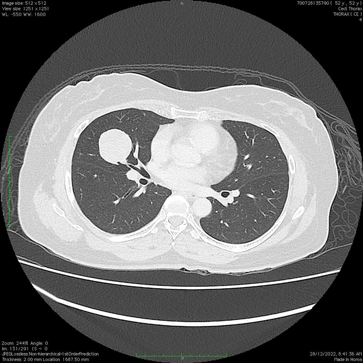 Pulmonary Endoscopy tweet media
