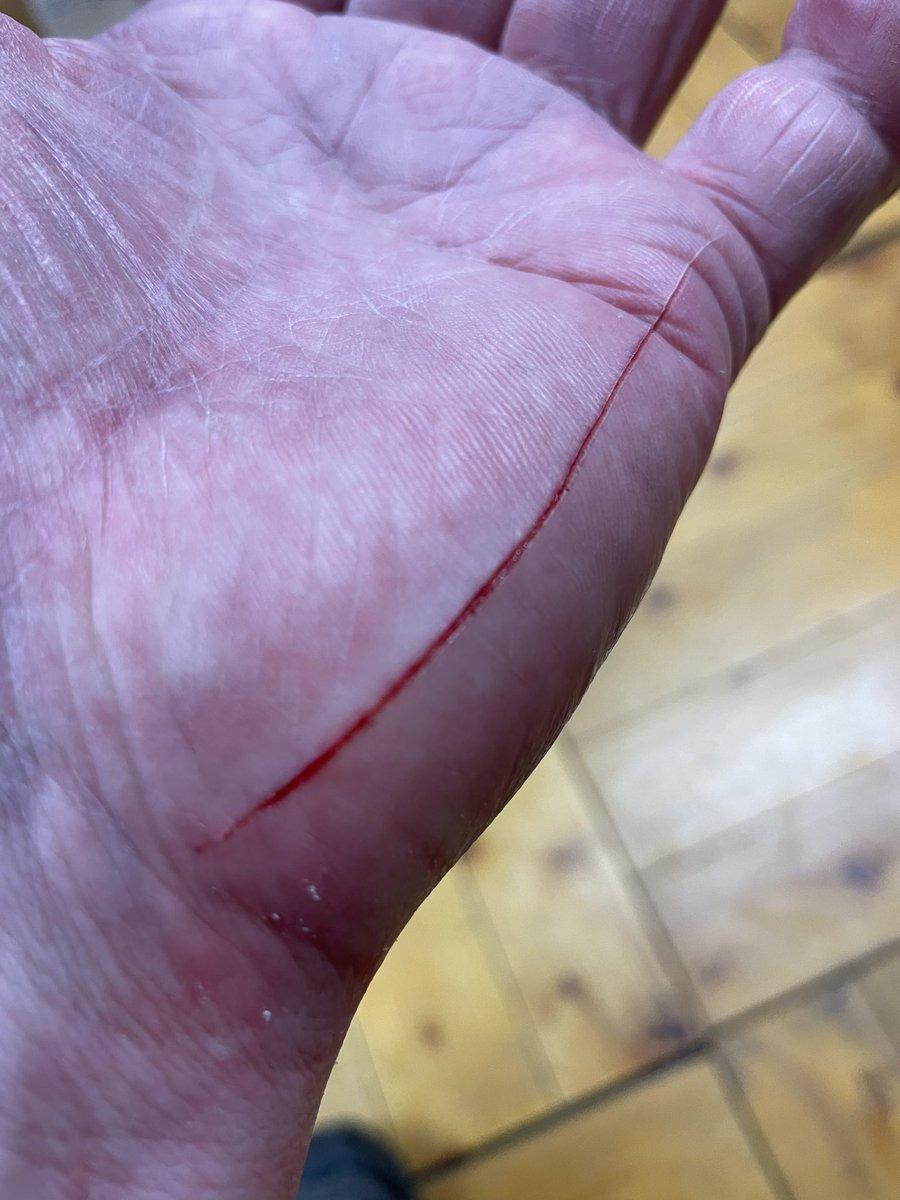 bouldering_ft's tweet photo. 閲覧注意⚠️
本日の成果
思ってる程傷は深くない👍
 #花崗岩の洗礼 https://t.co/nOn89NC8vg