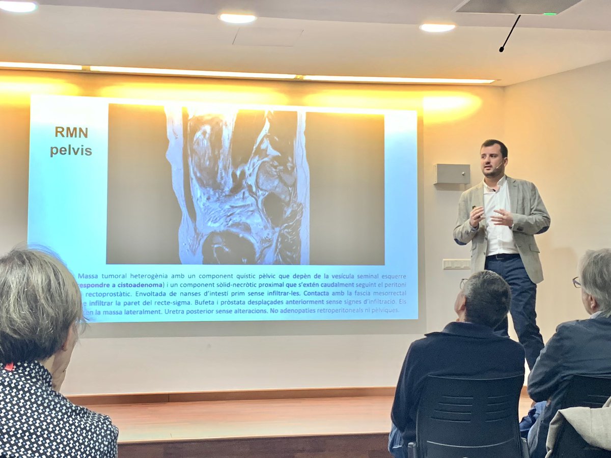 scurologia's tweet photo. Les masses de comportament incert prostàtic tenen comportament impredictible i alguns d’ells poden associar-se a sarcomes, especialment en pacients més joves. 
Cas presentat per @ArnauAbella de @UroHub a la #sessioresidents
Enhorabona! https://t.co/4tIiQGMEzh
