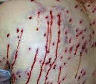 AshKickerUSA's tweet photo. Iz gon b alrit Dale, #Wilbur sayz iz jus a flesh wewnd kuz #WalmartWilly waz uzin #BirdShot🔫 n u shuld b out the #Klinik🏥 n no tim‼️
No uv had sum #BadLuk😢 latlee, but ur gon hav 2 suk it up n get bak 2 #KartRepurpusin🛒♻️ 2 mayk 💰
Hop #MongoMikey🤤 iz ok 2 n mayd it bak 🤞🏻 https://t.co/kGrjTPPf9c