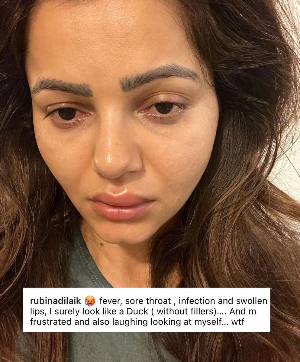 BtownKi's tweet photo. Get Well Soon #RubinaDilaik ! 

 #biggboss16  #biggboss16winner #biggboss14 #biggboss14winner #rubina #rubinav #ruby #rubiholics #rubyholics #rubinaistheboss #bossladyrubina #rubinadilaikfans #priyankachaharchaudhary #shivthakare #shalinbhanot #archanagautam #mcstan https://t.co/9NhZ3zGdmd
