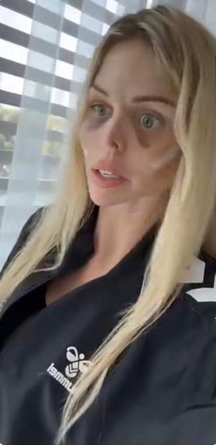 Continuez la chirurgie esthétique les filles, continuez…