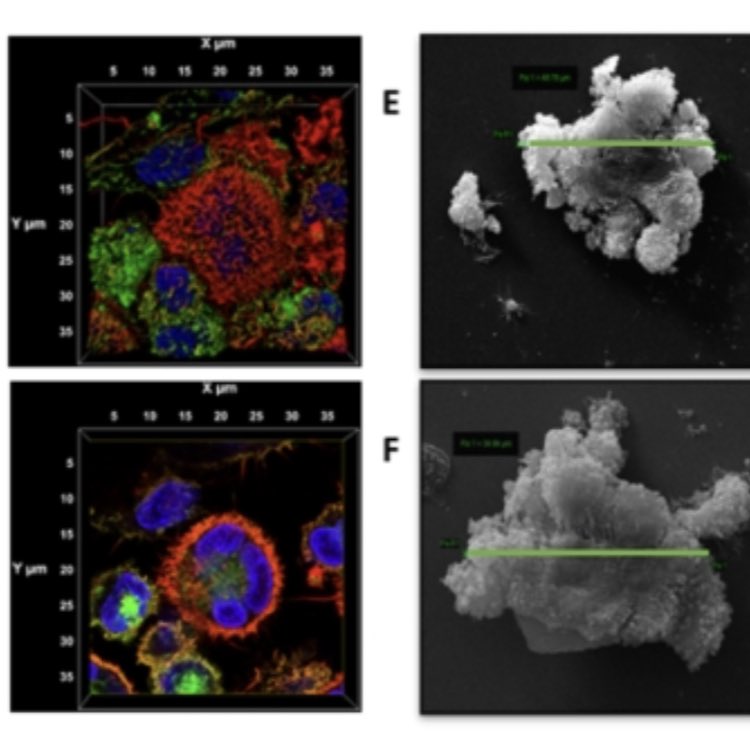 Perseverance…. Eleven years after having the idea and ten years after many people have grafted very hard, our work on how granuloma form in systemic ANCA Vasculitis is finally coming out . At this rate I have one more publication before retirement !