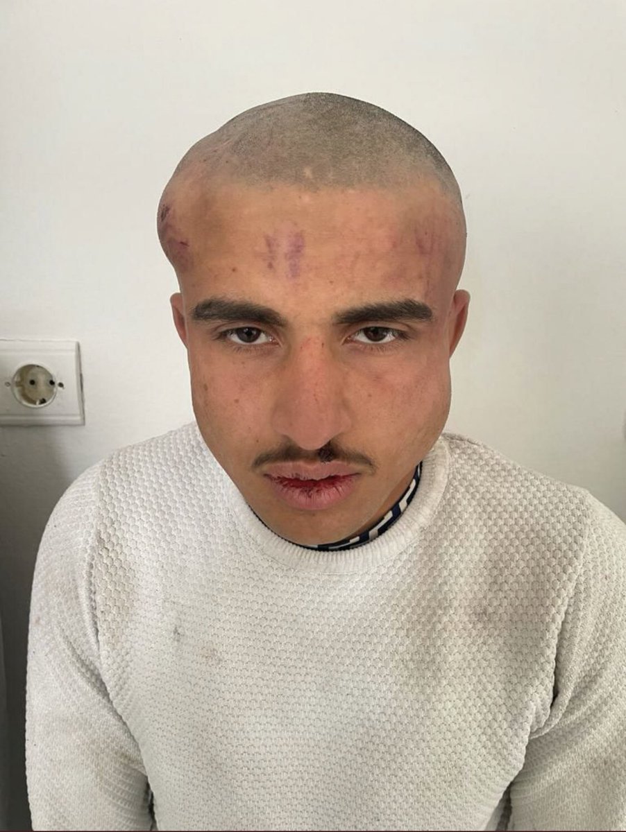 Deprem bölgesinde yakalanan 3 yağmacı merdivenden düştüğü tahmin ediliyor!

#hatay #deprem #asker #depremin6 
#ölmüş #hatayantakya #tahaduymaz #taha #SesimiDuyanVarmı #asker Taha deprem son dakika #SonDakika