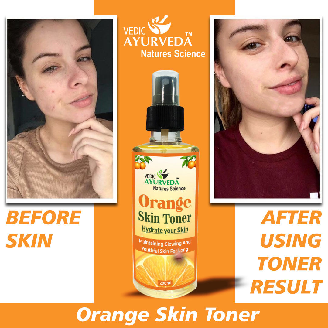 VedicAyurveda01's tweet photo. Orange Skin Toner Hydrate Your Skin (After/Before)...
https://t.co/tlvUScXggM
#orangetoner #toner #orange #skincare #orangetonerforskin #orangeskintoner #afterbefore #skincareproducts #daliyglow #beauty #wow #newpost #exploremore #likes #likesoflikes #instagram #ecommerce https://t.co/kyumoCUq3A
