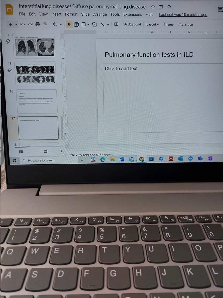 rosc_md's tweet image. Working on my grand rounds and waiting on when &quot;PGY-3 will be chill&quot;.

#pulm Twitter any recs appreciated 🙏