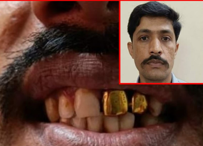 deshhit_news's tweet image. दातों की चमक और मुस्कुराहट ने 16 साल से फरार आरोपी को पहुंचाया जेल।
#GoldPlatedCheater #LICAgent #Maharashtrapolice #DeshhitNews 

deshhit.news/the-shine-of-t…