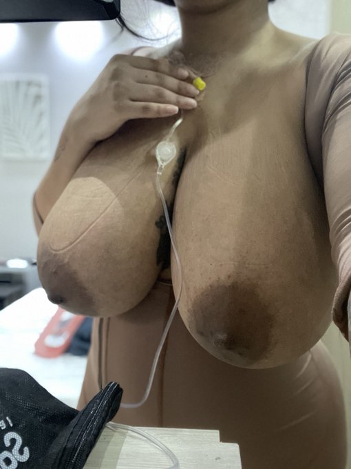 🏥Recovery https://t.co/lFkkHLAkjF