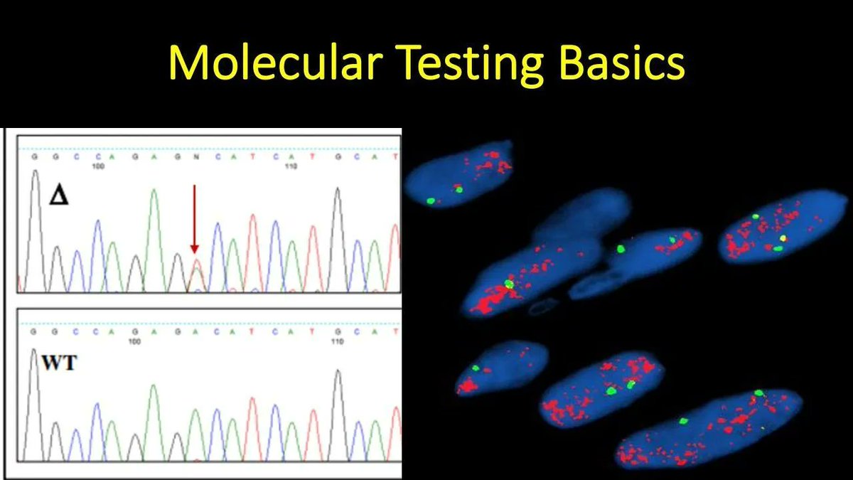 JMGardnerMD's tweet photo. Molecular Testing Basics explained in 15 minutes (video): https://t.co/CaTqBCVhEY. A simple explanation of the main types of molecular tests #pathologists use, when we use them, &amp; why. #pathology #pathTwitter #MedTwitter #MedEd #MolPath #dermtwitter #dermpath https://t.co/e6ufMST7qG