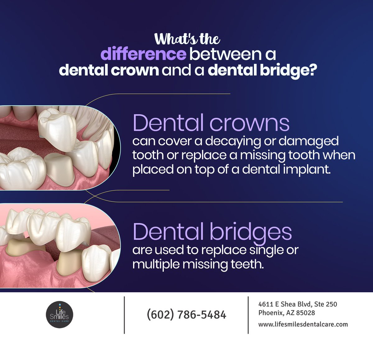 Despite their differences, dental crowns and dental bridges are both tooth replacement options that can be important for maintaining oral health. Find out which option best suits your needs at lifesmilesdentalcare.com #phoenix #arizona #lifesmilesdentalcare