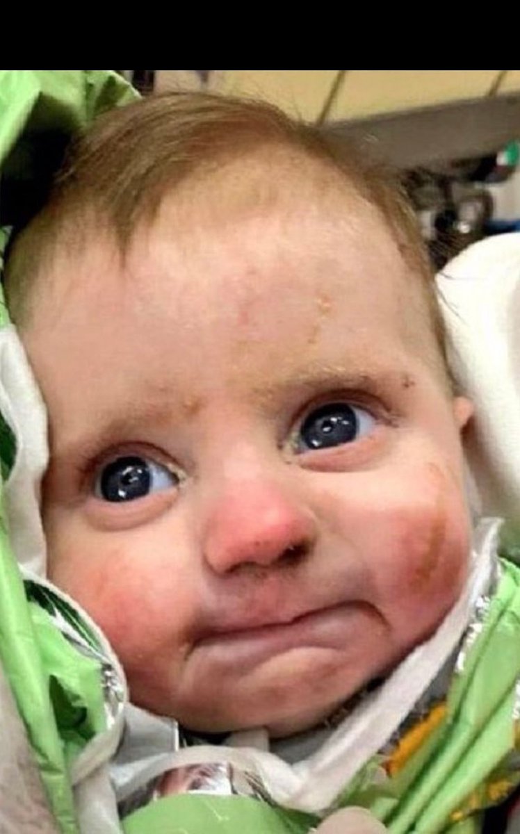 Buraya Kalbimi Bırakıyorum ❤️❤️

Bekir Bozdağ TOKİ Ahmet Nur Çebi Haram  Cumhurbaşkanı Erdoğan Elif Tügva Meral Akşener Arda Güler Turgay Enkazdan Diyarbakır'da Depremzedelere Lütfü Savaş Yapmayın 
#uzaktan #ölmüş #kahramamaras #ahbapmaras #ahbapacil #YARDIM #polis #asker