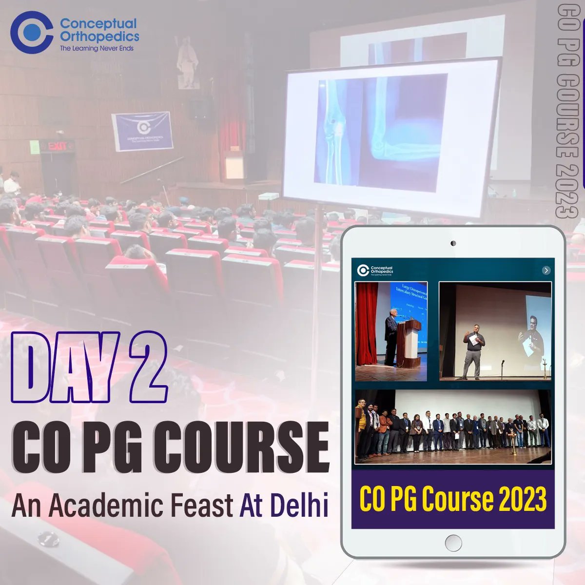 Day-2
CO PG Course an Academic Feast
Keep following @conceptualorthopedics for regular updates.
.
.
#conceptualorthopedics #copgcourse #drapurv #orthopedics #delhi #copg