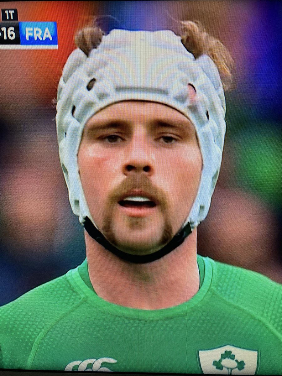 rogerchilds2u's tweet image. Am I the only person who sees this? #IREvFRA #PutEmUp