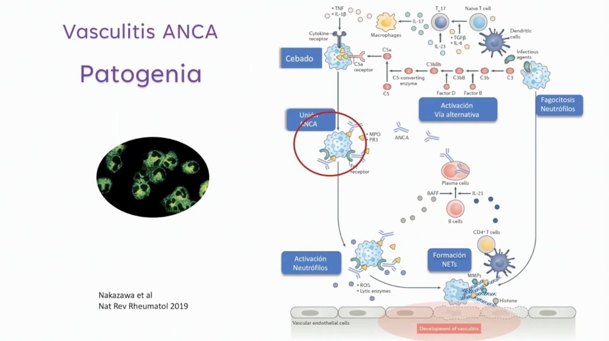 joraltron's tweet photo. Potencial terapéutico de #avacopan en #vasculitis #ANCA
Dr. Iñigo Rúa-Figueroa
#25TenTopicsBCN #TenTopics https://t.co/dKwXUHgXGI