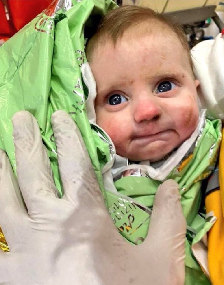 #11Feb #Turquía 
<a href="/DanteFontana3/">Dante Fontana</a>: Este es el rostro de la esperanza! Tiene apenas 2 meses y fue salvado después de 5 días bajo los escombros!