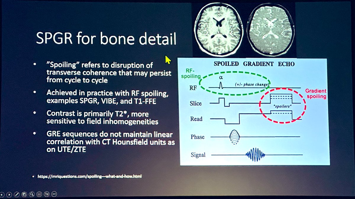 The_ASSR's tweet image. Our #ASSR23 Vice President @LeviChazen from @HSpecialSurgery teaches us about Bone MRI in the Spine Imaging Innovations &amp;amp; AI session. Fascinating how we can turn an MRI into CT bone images! -@JudyGadde #NeuroRad #SpineRad