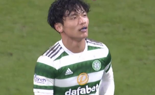 Well done bhoys💚 Today's Leo looked like Modric👏 As you know, I fell asleep from just before start of the game, so I made a blunder of missing Daizen's goal😅 Is it true that Kyogo was injured?😭 I'm a little worried.
#CELSTM #ScottishCup #COYBIG #CelticFC