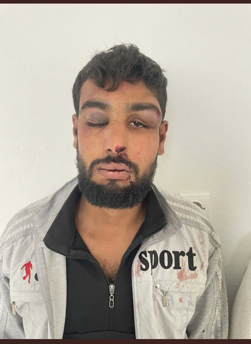 İki resim arasındaki yedi farkı bulun. Veya durun, ben söyleyeyim. Benim necip halkım küçük hırsıza ceza kesmeyi çok iyi bilir.