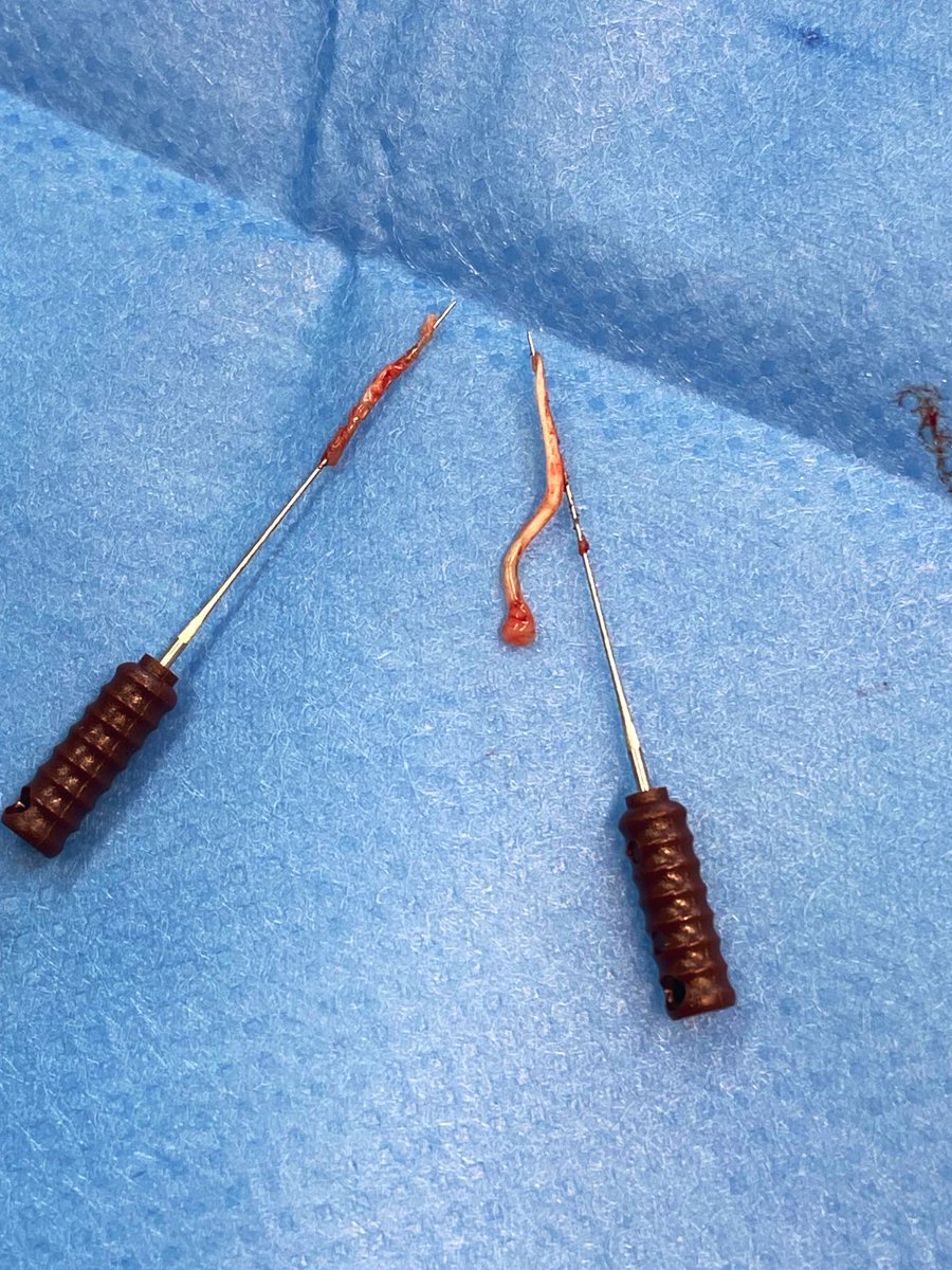 En 1 morceau, hypeeer satisfaisant