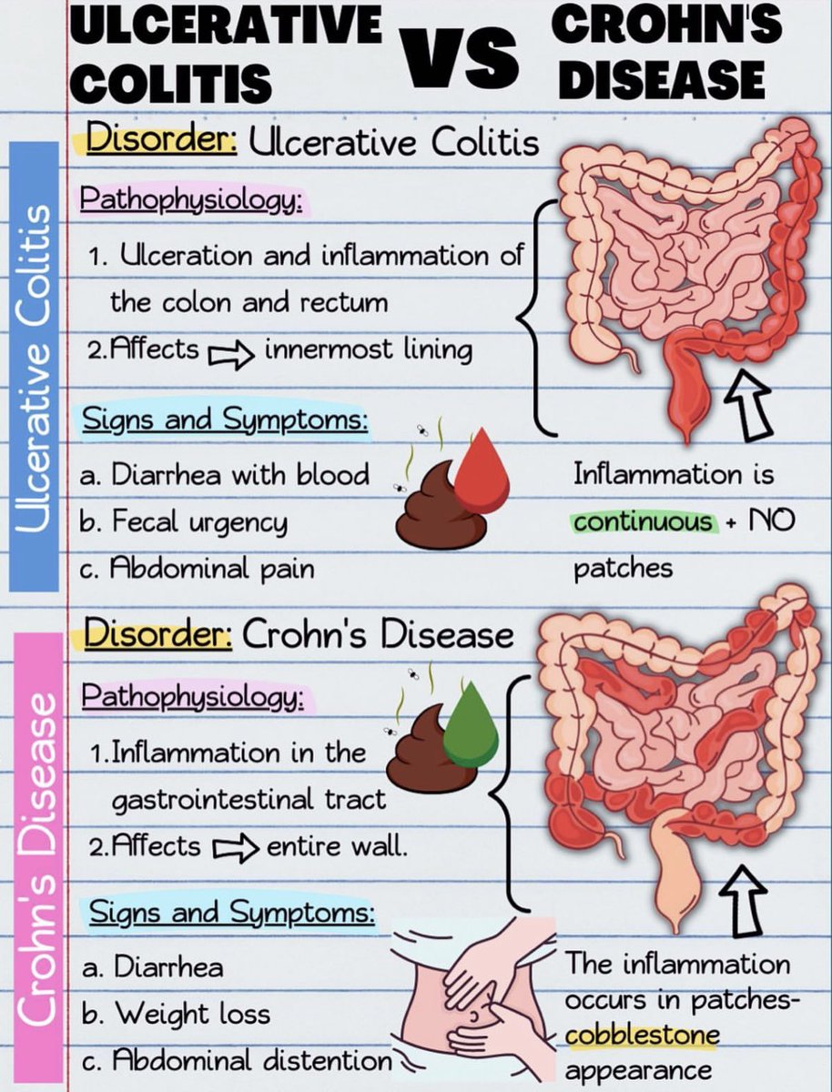 ClinicalClubCE's tweet photo. Ulcerative Colitis Vs Crohn’s Disease
Reference:Dynamed
#clinicalclub https://t.co/jhY6XgGt9y