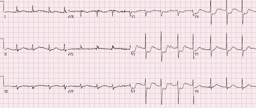 Dr Joshua Walinjom on Twitter: 