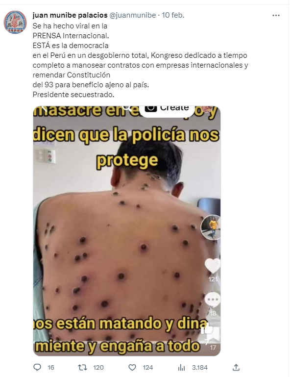 PKN2023's tweet photo. #URGENTE
🚨🇵🇪 Durante semanas esta imagen estuvo circulando por las redes sociales para acusar a la @PoliciaPeru  de disparar contra civiles, sin embargo...
Esta imagen pertenece a un paciente con viruela símica fechada el 13 de Nov 2022 en México
👇 https://t.co/jWY412odY7