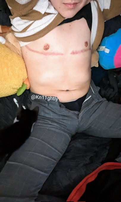 Feeling hot tn 😉 #hot #nude #ftm #queer #cute https://t.co/ahSgK9BObq<a href="/tag/hot"class="tags">#hot</a><a href="/tag/nude"class="tags">#nude</a><a href="/tag/ftm"class="tags">#ftm</a><a href="/tag/queer"class="tags">#queer</a><a href="/tag/cute"class="tags">#cute</a>