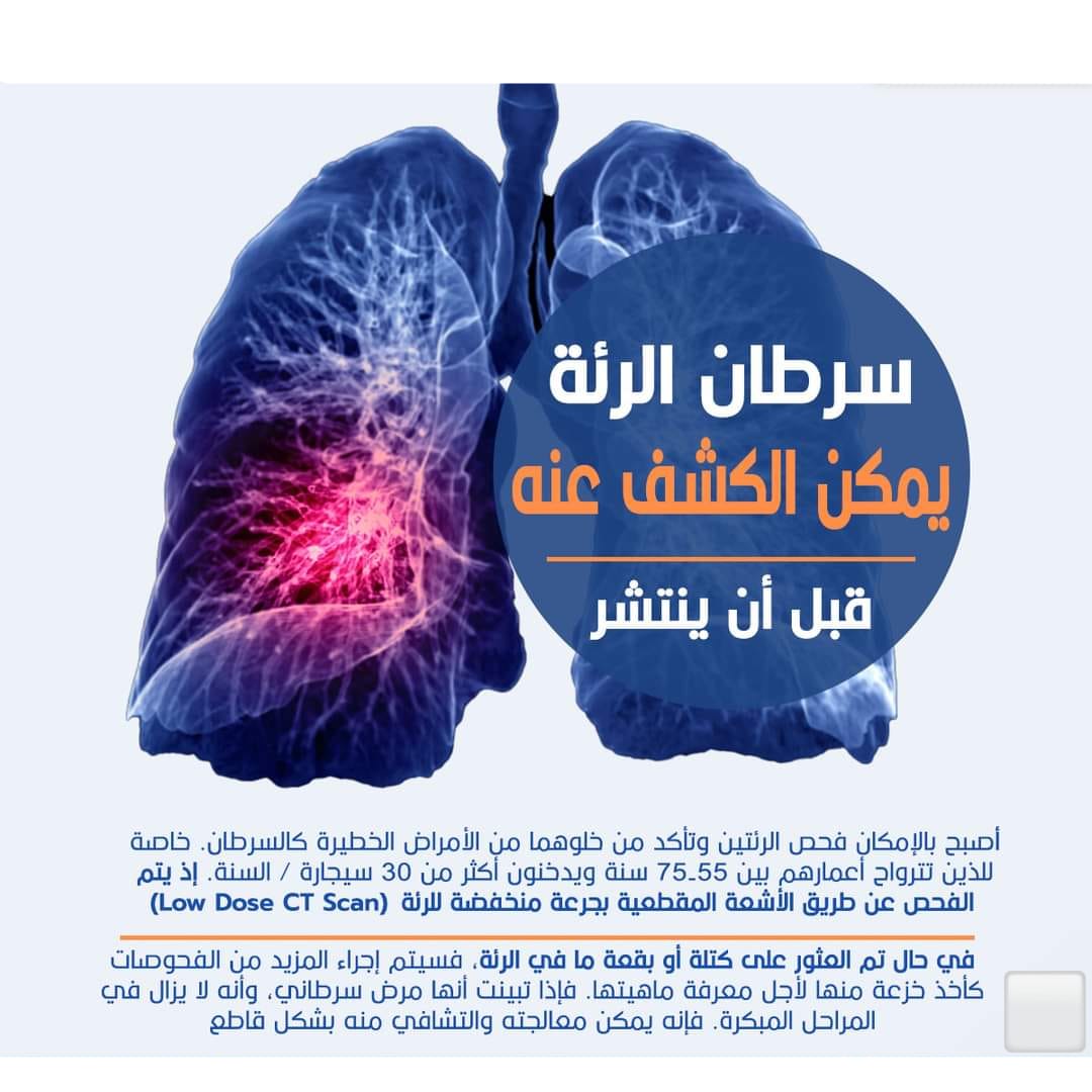 IPS_TEAM's tweet photo. دواعي فحص سرطان الرئة قبل أن ينتشر https://t.co/jx4nLHvqzo