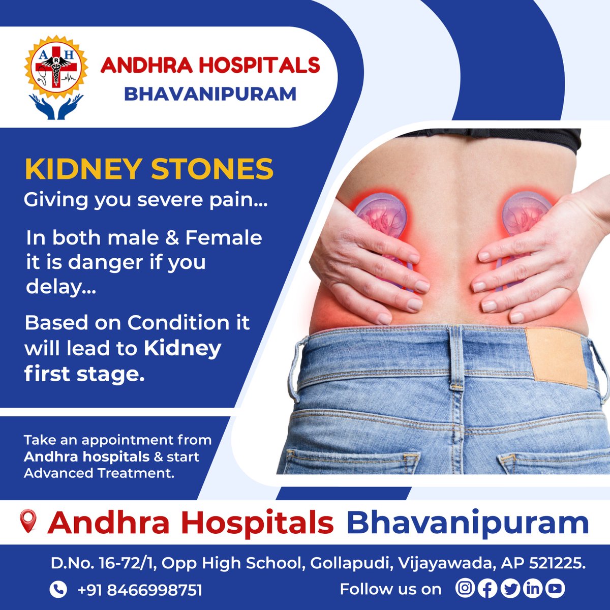 For More Info Visit Us: andhrahospitals.org/ah
Call Us on:+91-8466998751
.
.
.
#andhrahospitalsbhavanipuram #AndhraHospitals #bhavanipuram #kidneyproblem #kidneypain #kindneyfunction #kidneydisease #kidneytransplant #kidneyfailure #dialysis #urology #urologist #nephron