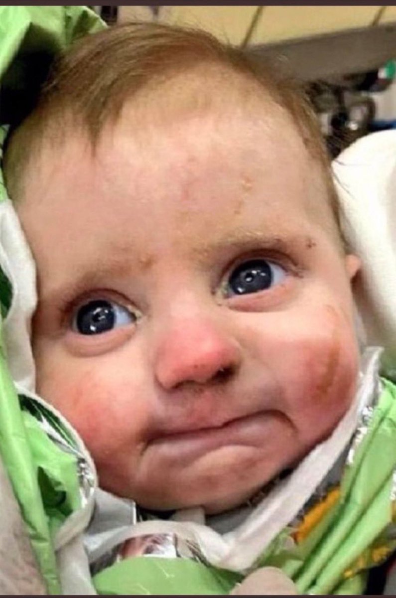 2-month old fought 128 hours to survive under the rubble after Turkey earthquake. Big brown eyes, slight smile, special kid 💪