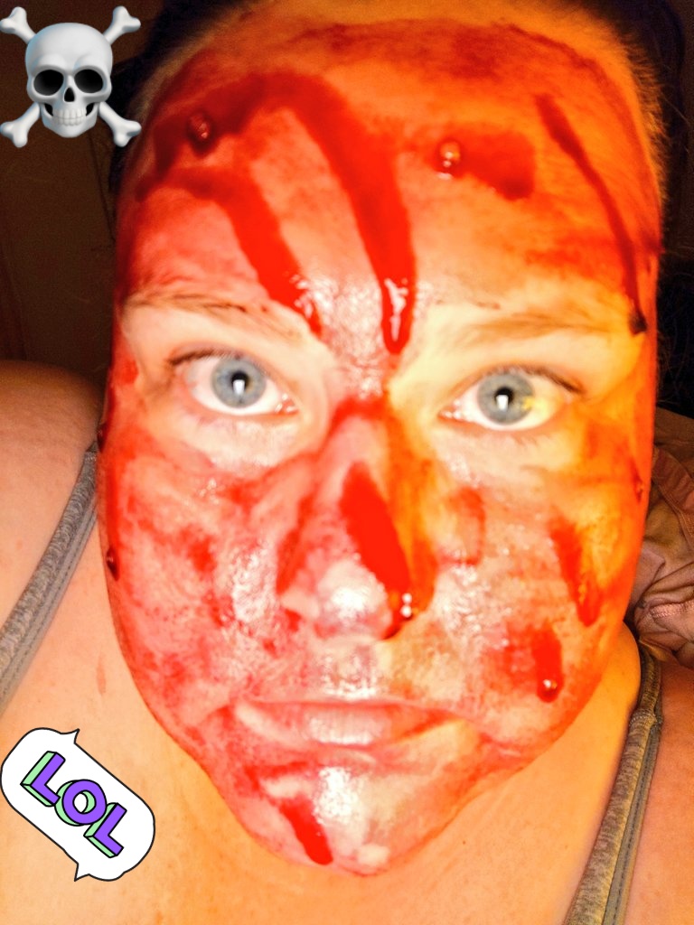 Manxy_Girl's tweet photo. Did my BHA/AHA peeling solution to try to make my skin cells turn over faster due to an allergic reaction that caused scabs & hive spots. But it looks like I have been in an accident or I slaughtered someone. #theordinary #peelingsolution #BHA #AHA #skincareproducts #skincar https://t.co/KHUHR5m8tR