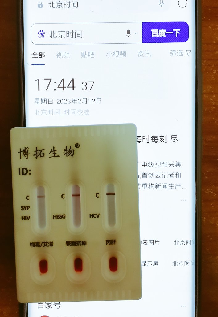 jacb_z's tweet photo. 每个月的定时检测🧐🧐🧐 https://t.co/GGcUZ2MHeG