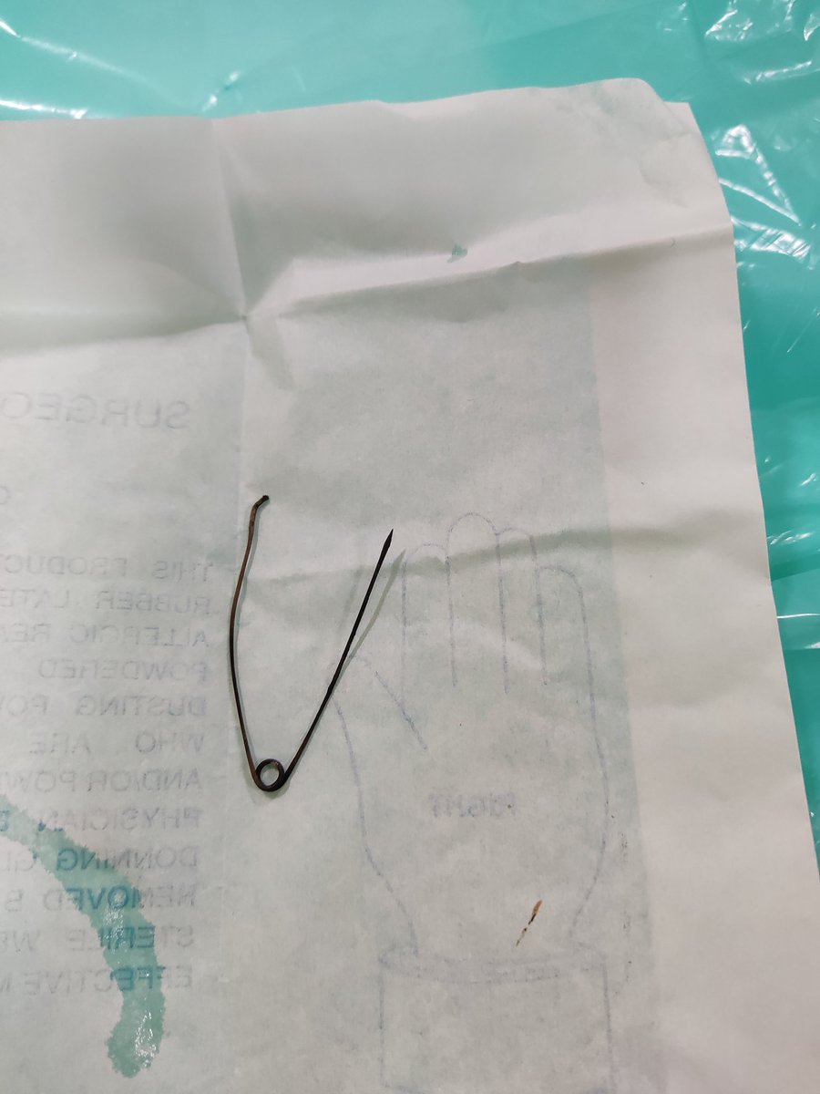A 9 month old baby presented with FB ingestion (safety pin), struck in stomach for more than 72 hours. Endoscopy showed 1 end of open safety pin lodged in stomach wall.. Removed successfully without any complication. 
#pediatricgastroenterology
#pediatricendoscopy 
#giendoscopy