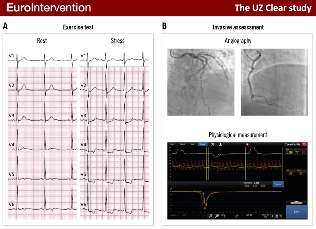 eurointervention-on-twitter-in-this-prospective-study-including