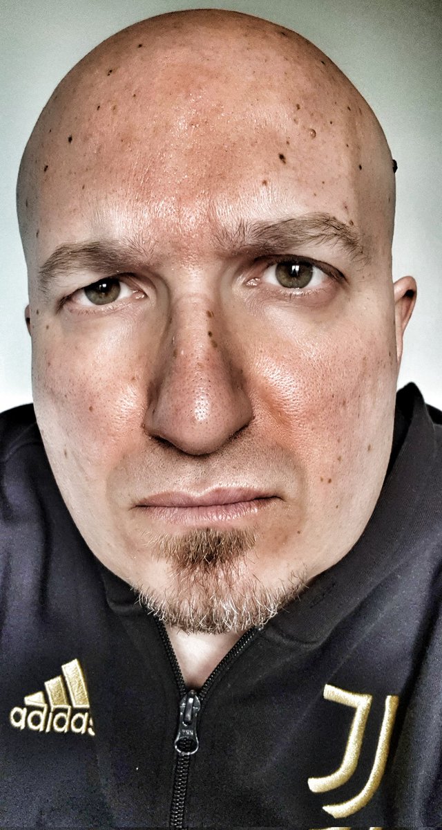 delio_petrelli's tweet photo. Pronto per #JuveFiorentina.
Il nostro campionato è stato FALSATO da UN'INGIUSTIZIA SPORTIVA.
Bisogna essere realisti, fare il prima possibile 40 punti, puntare a VINCERE #EuropaLeague e #CoppaItalia.
E difendere la @juventusfc in tutte le sedi.
UNITI.
#FinoAllaFine. ⚪⚫💪👊🏿 https://t.co/i9DFzE2iFD
