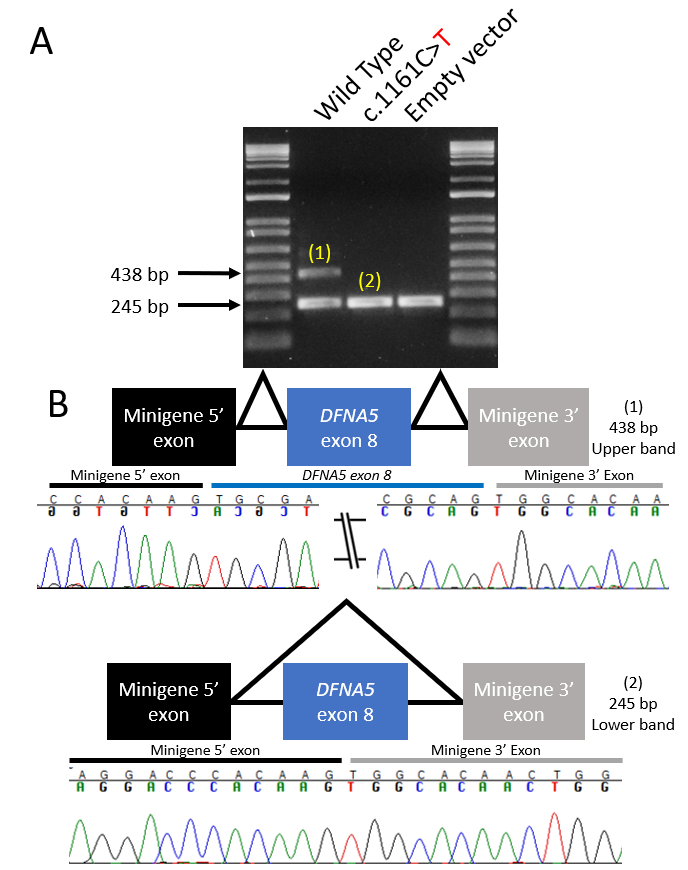 Come learn from Joseph Chin about the first "synonymous" variant in DFNA5 that affects splicing and cause dominant hearing loss at poster #SU102 <a href="/AROMWM/">ARO</a> #ARO2023 
<a href="/IowaMed/">Carver College of Medicine</a> <a href="/IowaOto/">Iowa Oto</a>