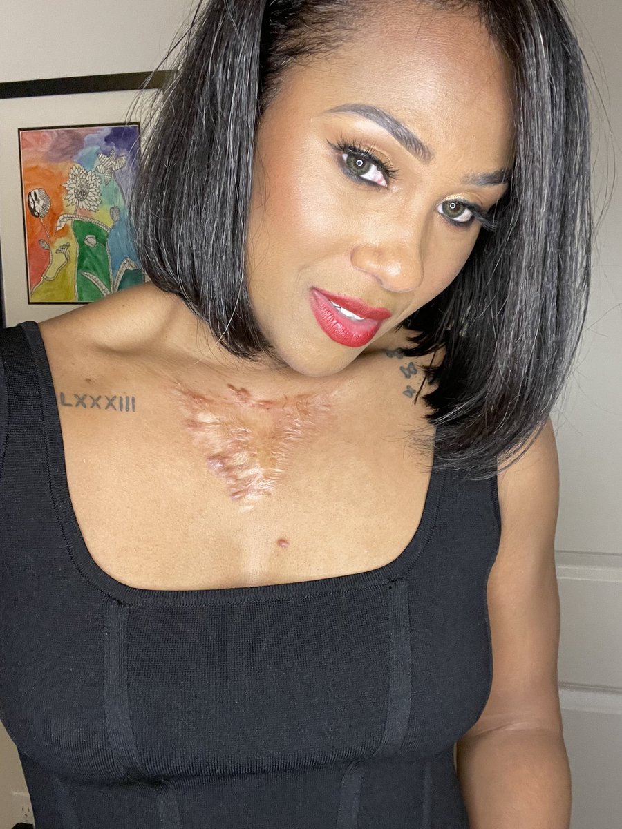 scarpowerco's tweet photo. Your scars don’t make you, you make them! 💪🏽💕 #scarpower #scarlightcoaching #scars https://t.co/kdftxFTBLU