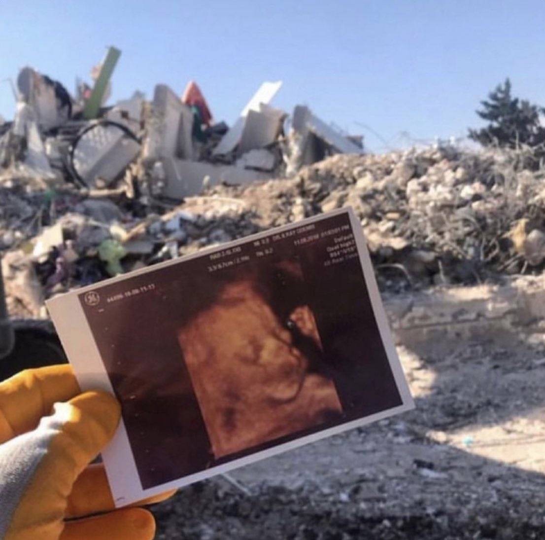 Benim kalbim dayanmıyor…